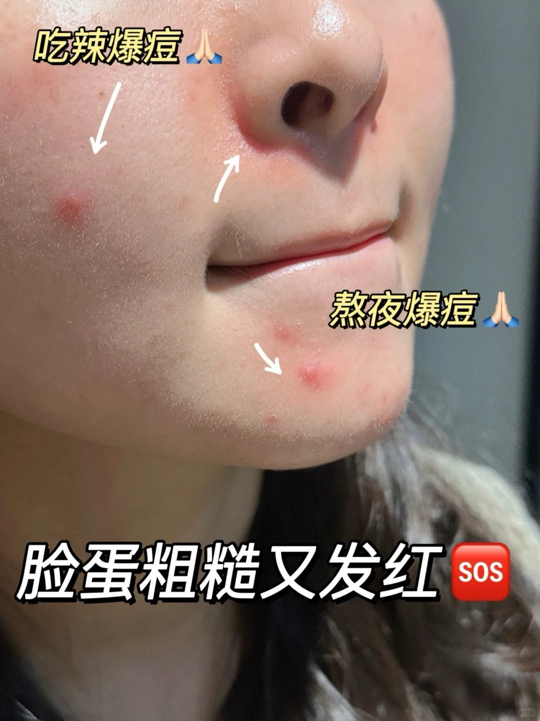 理肤泉B5面膜PRO版 /10片