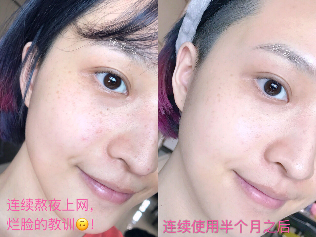 Kiehl’s 美白淡斑精华
