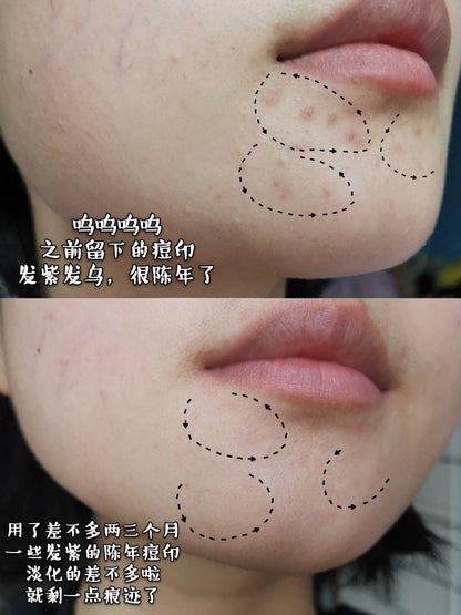 Kiehl’s 美白淡斑精华