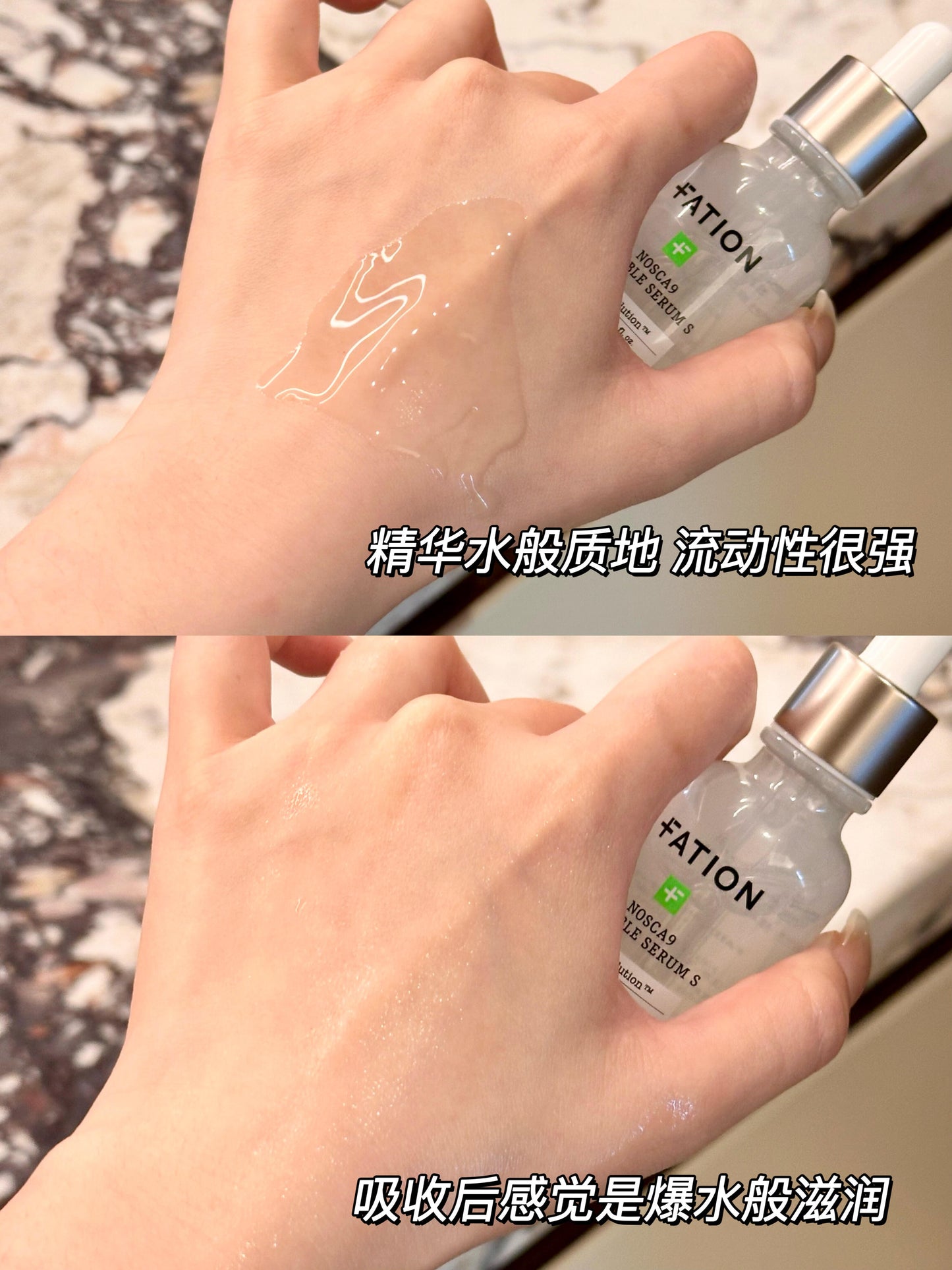 Fation祛痘精华 50+15ml🆓面膜