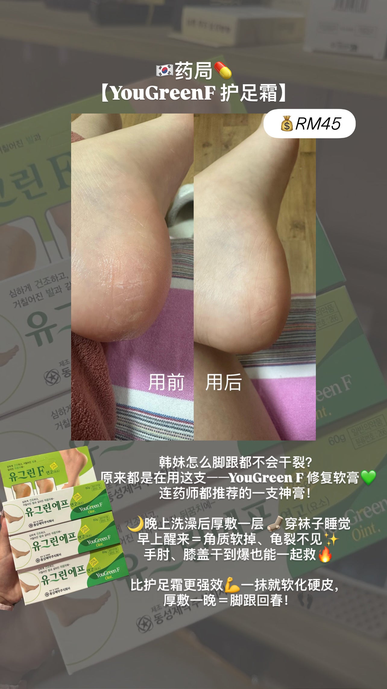 YouGreenF 护足霜 80g