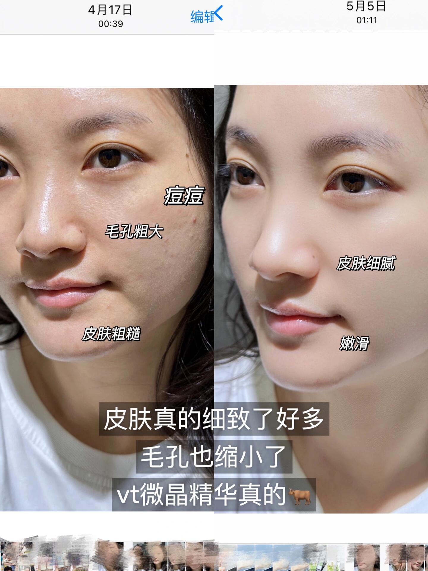 VT 100微针精华 1+1 +PDRN1 00 1.5ml*3