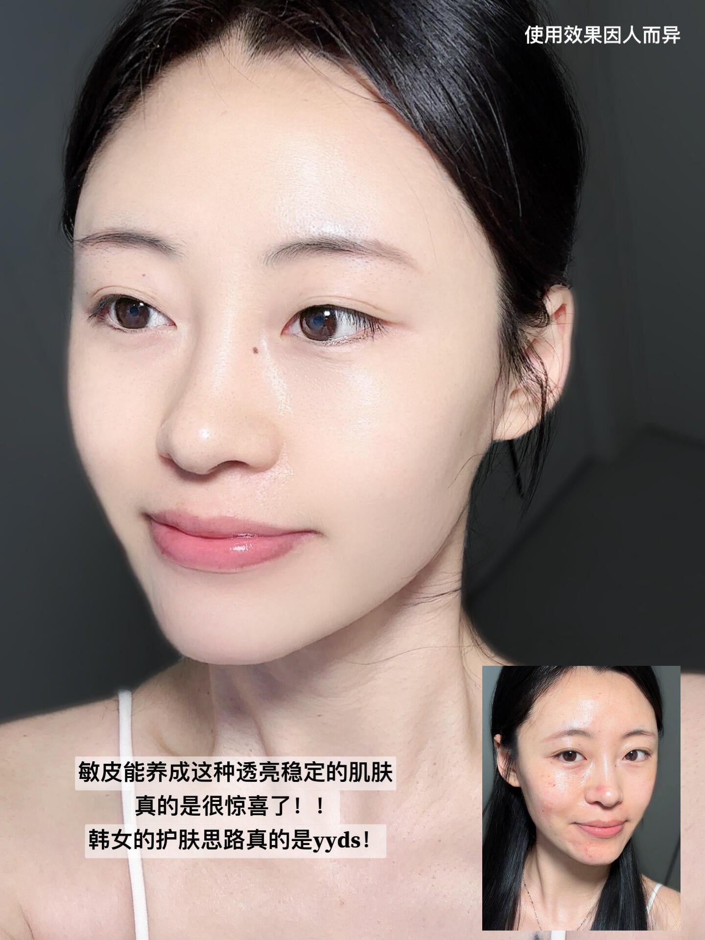 Mediheal 积雪草修护精华 40ml*2